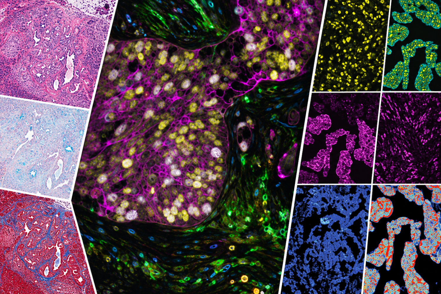 Collage of histology, fluorescence microscopy, and spatial tissue-analysis images showing cellular structures and biomarker patterns in tissue samples.