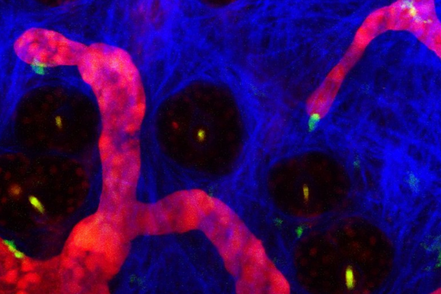 Intravital imaging of mouse skin dermis by a multi-photon microscope. Lymphatic vessels (Red), Langerhans cells (Green), and Collagen type I (Blue) – Courtesy of Park lab